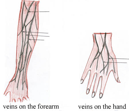 On the left is an image of the veins in the forearm and on the right is